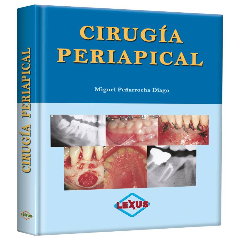 Lexus - Peñarocha Cirugía Periapical
